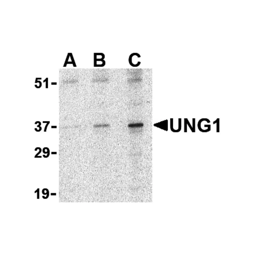 ProSci 3865_S UNG1 Antibody, ProSci, 0.02 mg/Unit Primary Image