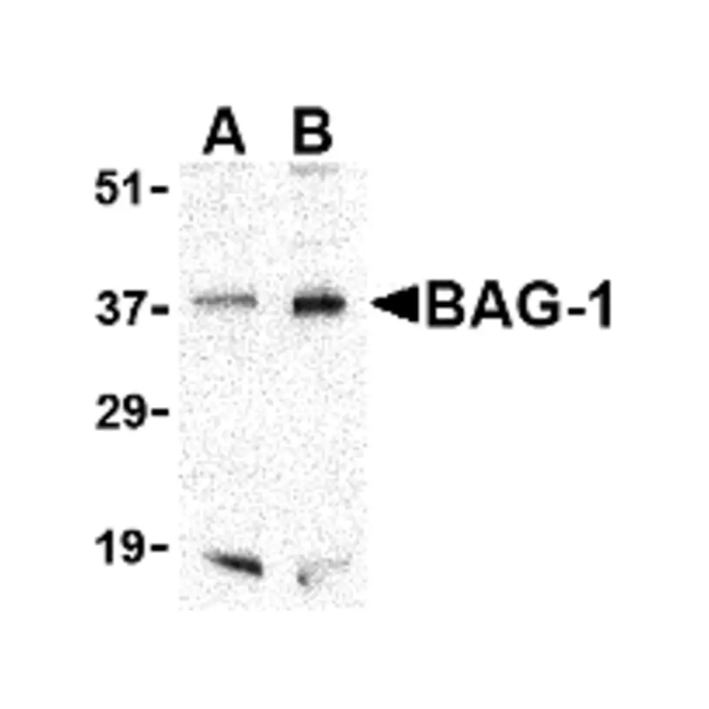 ProSci 3869 BAG-1 Antibody, ProSci, 0.1 mg/Unit Primary Image