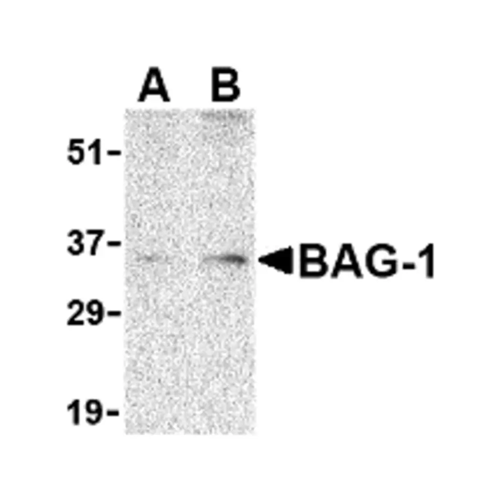 ProSci 3871 BAG-1 Antibody, ProSci, 0.1 mg/Unit Primary Image