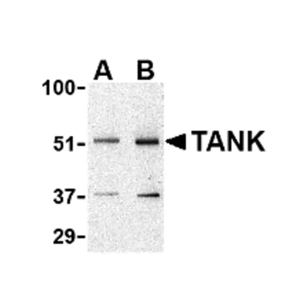 ProSci 3879_S TANK Antibody, ProSci, 0.02 mg/Unit Primary Image