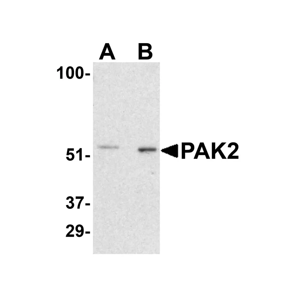 ProSci 3885 PAK2 Antibody, ProSci, 0.1 mg/Unit Primary Image