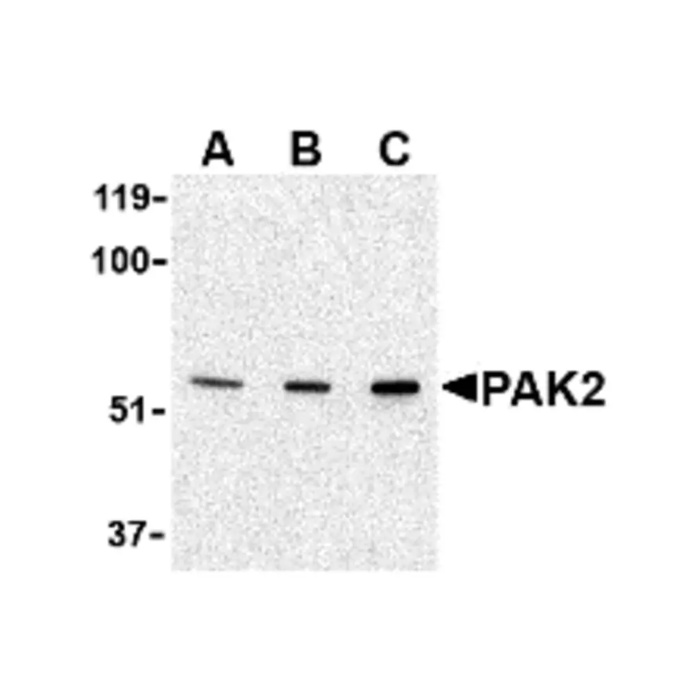 ProSci 3887 PAK2 Antibody, ProSci, 0.1 mg/Unit Primary Image