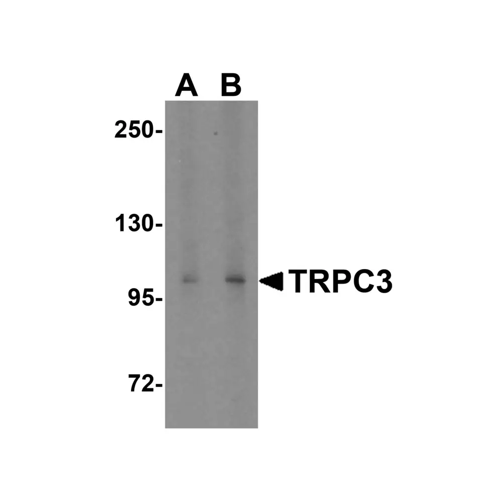 ProSci 3895 TRPC3 Antibody, ProSci, 0.1 mg/Unit Primary Image