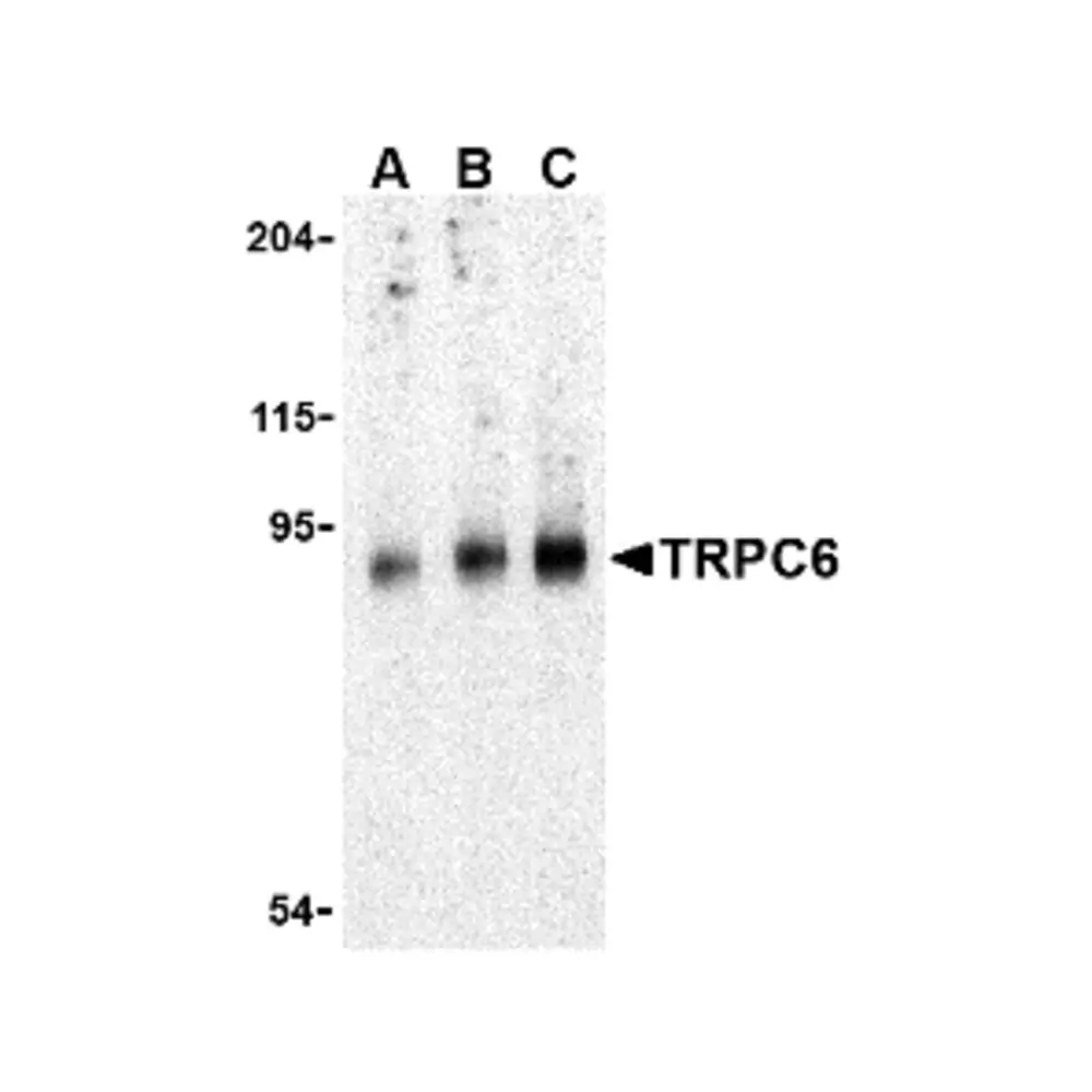 ProSci 3897_S TRPC6 Antibody, ProSci, 0.02 mg/Unit Primary Image
