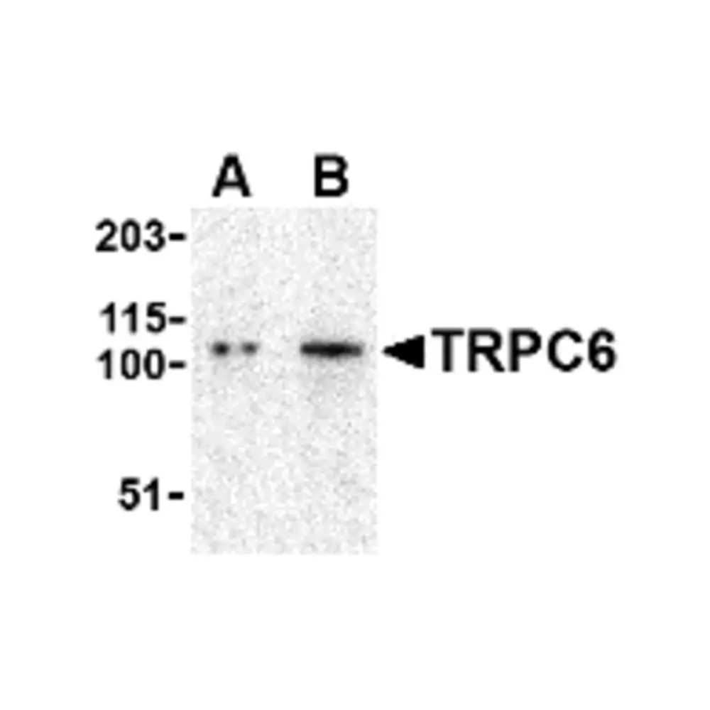 ProSci 3899_S TRPC6 Antibody, ProSci, 0.02 mg/Unit Primary Image