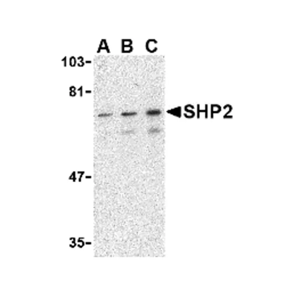 ProSci 3901 SHP2 Antibody, ProSci, 0.1 mg/Unit Primary Image