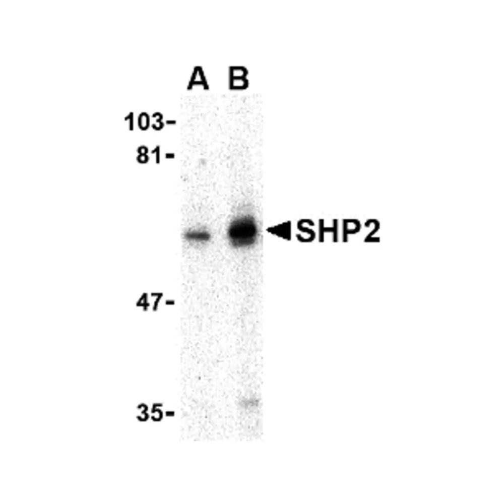 ProSci 3903_S SHP2 Antibody, ProSci, 0.02 mg/Unit Primary Image