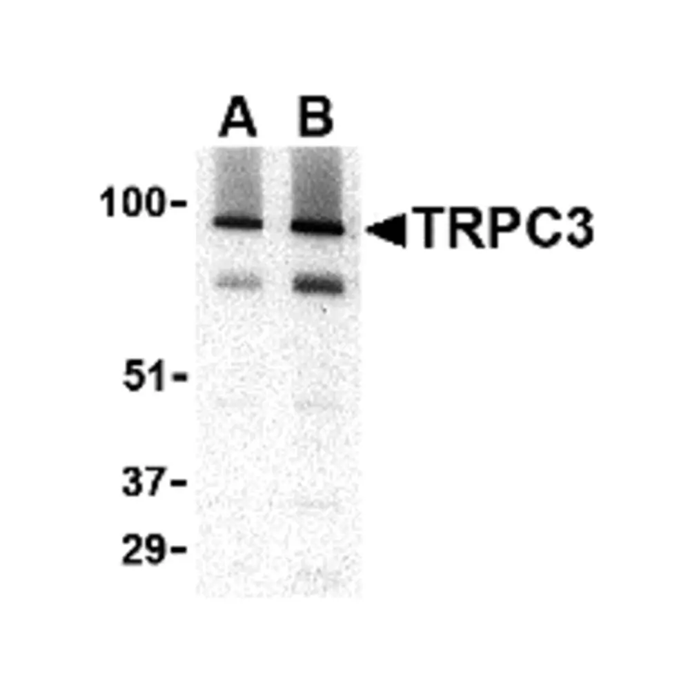 ProSci 3905 TRPC3 Antibody, ProSci, 0.1 mg/Unit Primary Image
