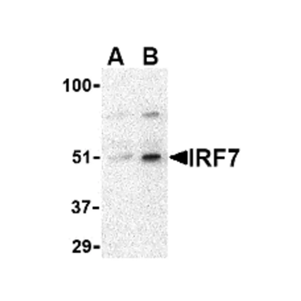 ProSci 3943 IRF7 Antibody, ProSci, 0.1 mg/Unit Primary Image