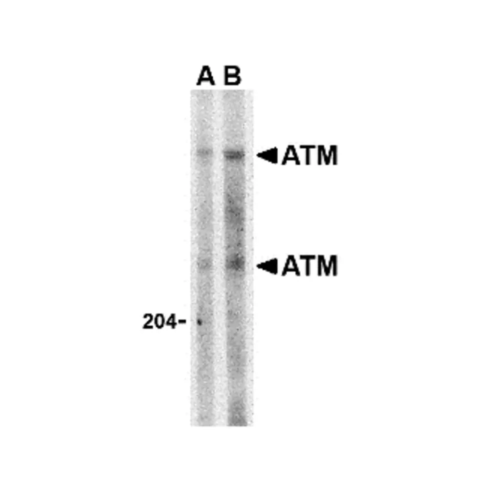 ProSci 3945 ATM Antibody, ProSci, 0.1 mg/Unit Primary Image