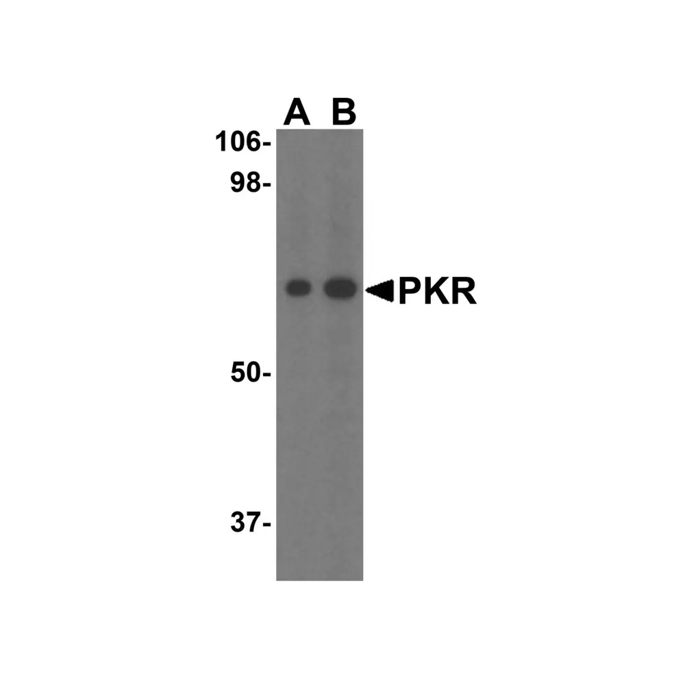 ProSci 3949_S PKR Antibody, ProSci, 0.02 mg/Unit Primary Image