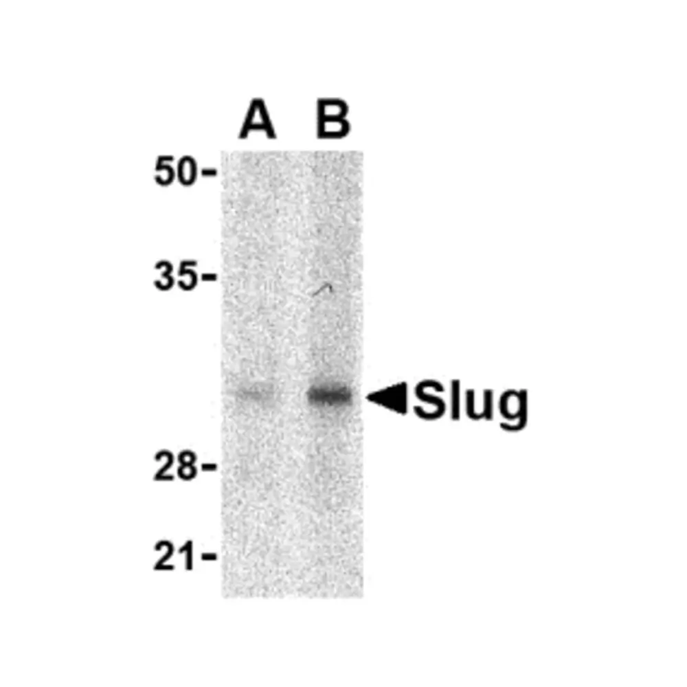 ProSci 3957 Slug Antibody, ProSci, 0.1 mg/Unit Primary Image