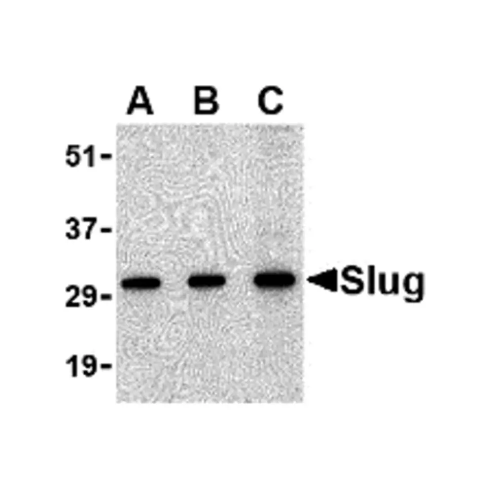 ProSci 3959_S Slug Antibody, ProSci, 0.02 mg/Unit Primary Image