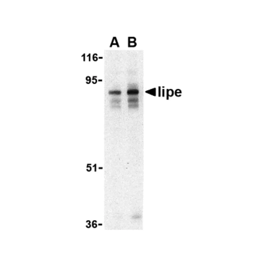 ProSci 3965 Lipe Antibody, ProSci, 0.1 mg/Unit Primary Image