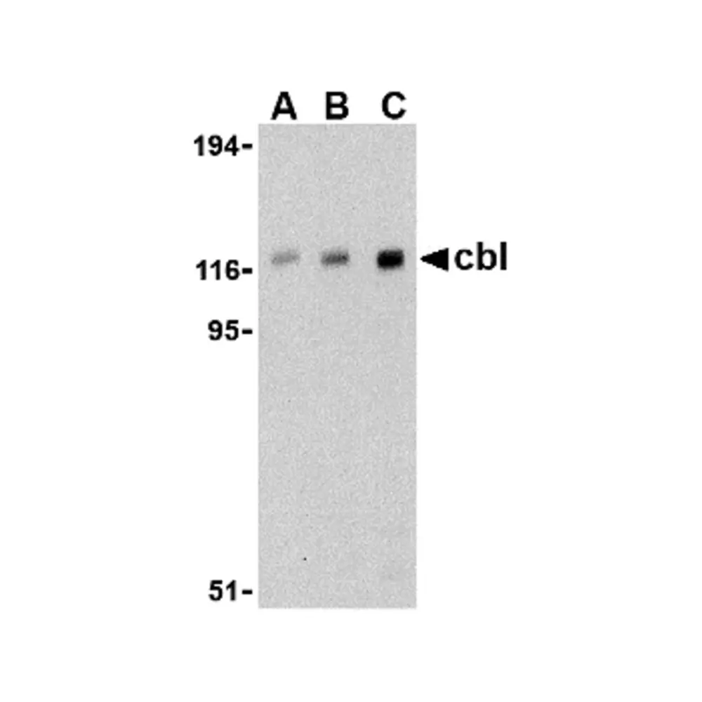 ProSci 3967 Cbl Antibody, ProSci, 0.1 mg/Unit Primary Image