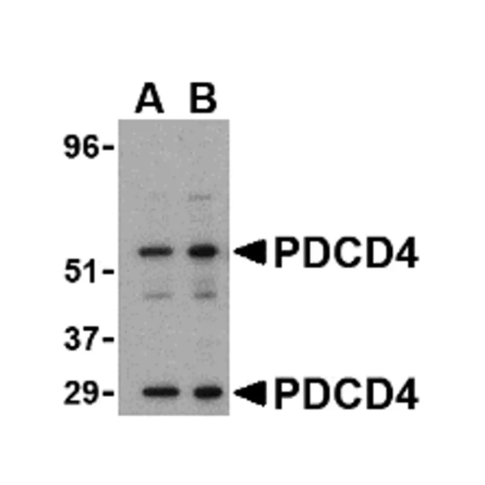 ProSci 3975_S PDCD4 Antibody, ProSci, 0.02 mg/Unit Primary Image