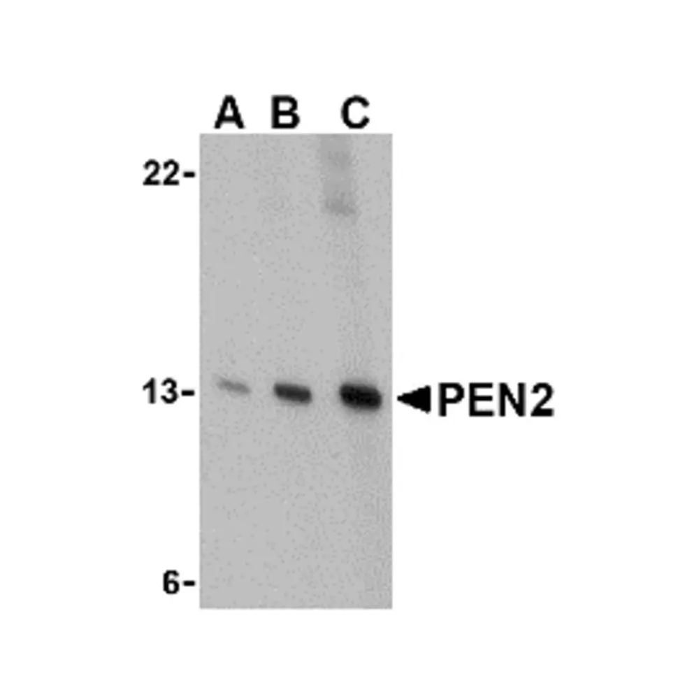 ProSci 3979_S PEN2 Antibody, ProSci, 0.02 mg/Unit Primary Image