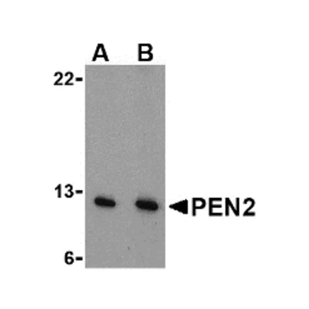 ProSci 3981 PEN2 Antibody, ProSci, 0.1 mg/Unit Primary Image