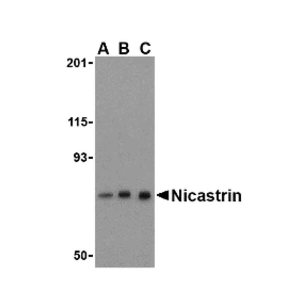 ProSci 3983 Nicastrin Antibody, ProSci, 0.1 mg/Unit Primary Image