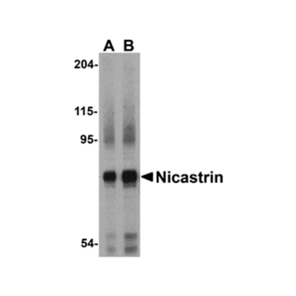 ProSci 3985 Nicastrin Antibody, ProSci, 0.1 mg/Unit Primary Image