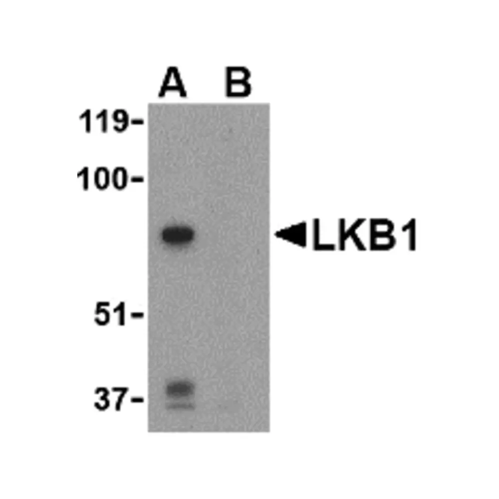 ProSci 3987 LKB1 Antibody, ProSci, 0.1 mg/Unit Primary Image