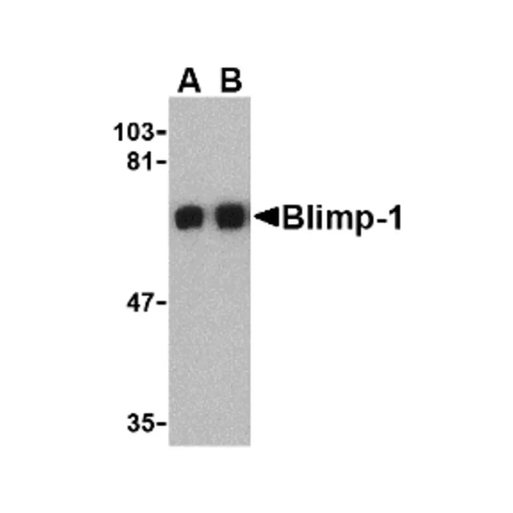 ProSci 3989_S Blimp-1 Antibody, ProSci, 0.02 mg/Unit Primary Image