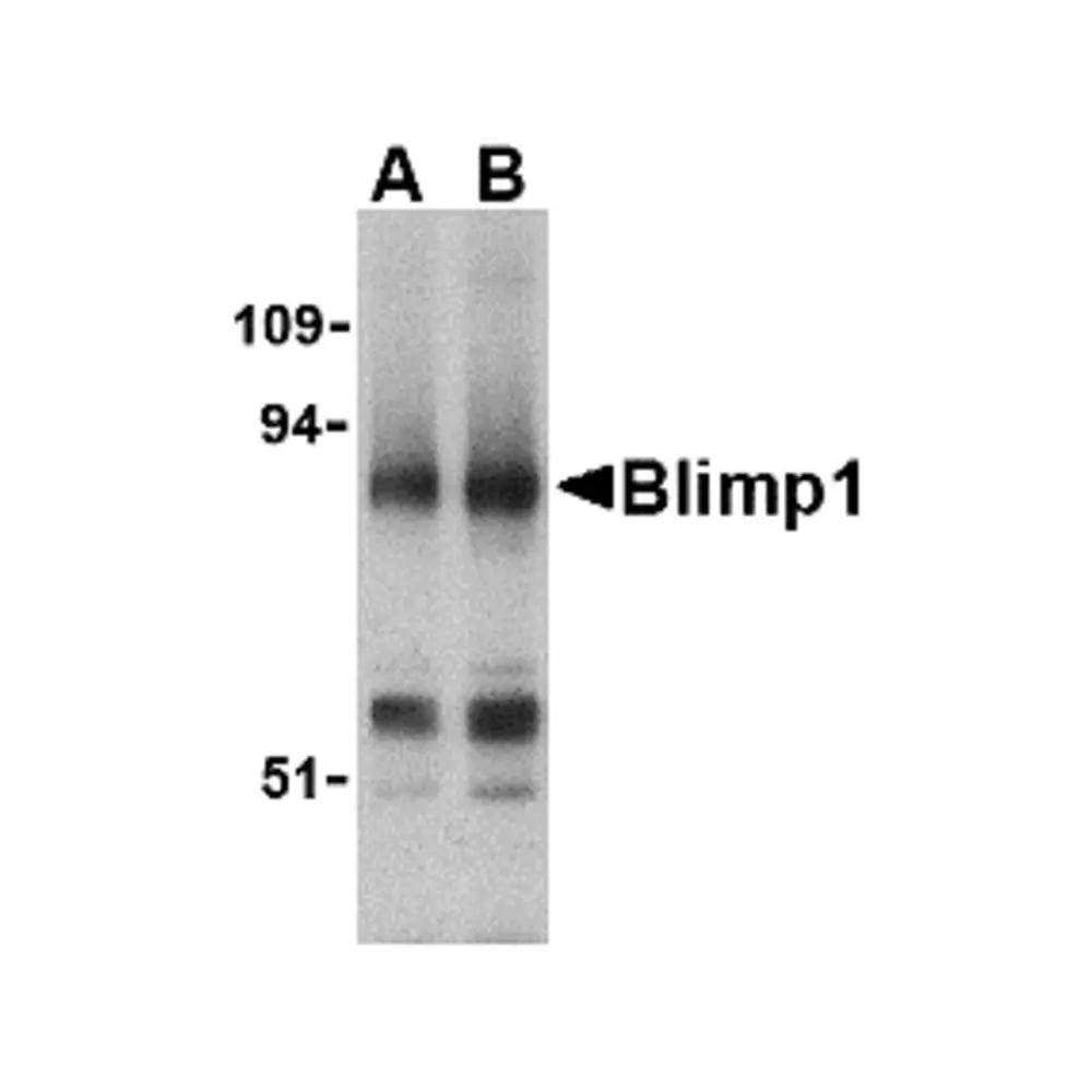 ProSci 3991_S Blimp-1 Antibody, ProSci, 0.02 mg/Unit Primary Image