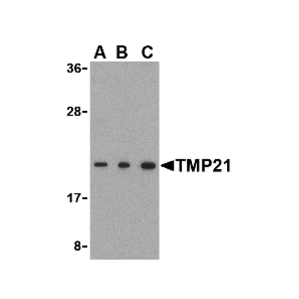 ProSci 3997 TMP21 Antibody, ProSci, 0.1 mg/Unit Primary Image
