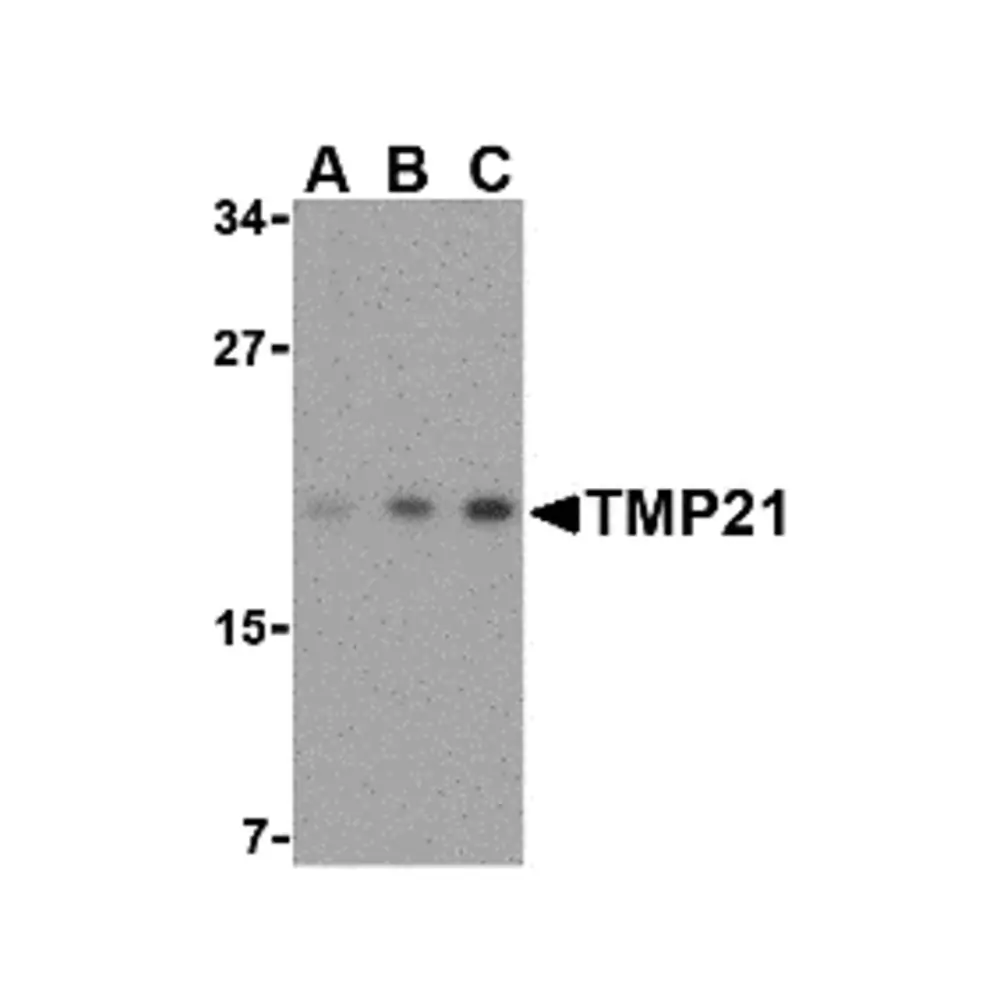 ProSci 3999 TMP21 Antibody, ProSci, 0.1 mg/Unit Primary Image