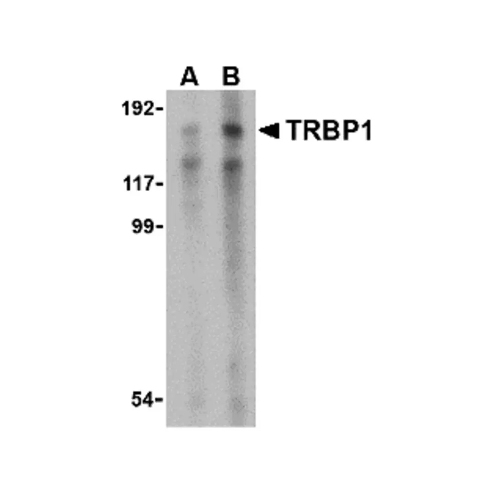 ProSci 4011 TRBP1 Antibody, ProSci, 0.1 mg/Unit Primary Image