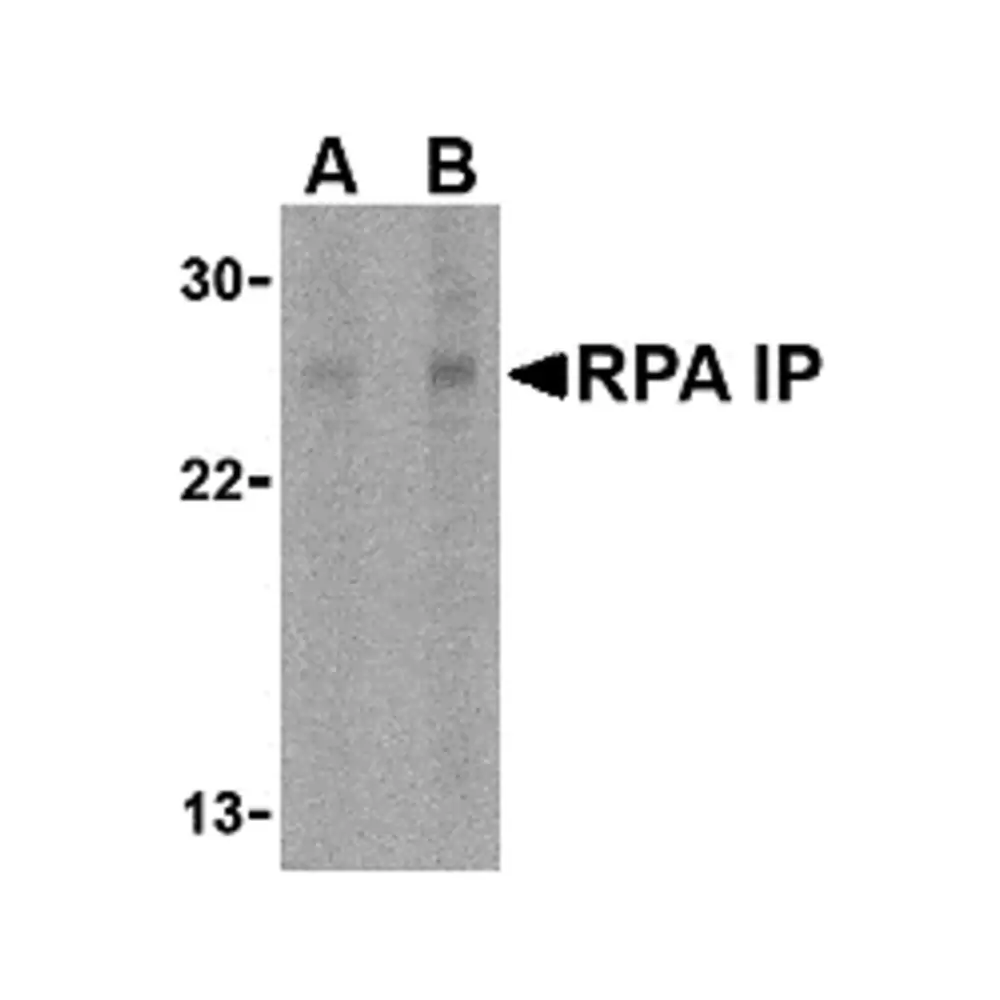 ProSci 4013_S RPA Interacting Protein Antibody, ProSci, 0.02 mg/Unit Primary Image