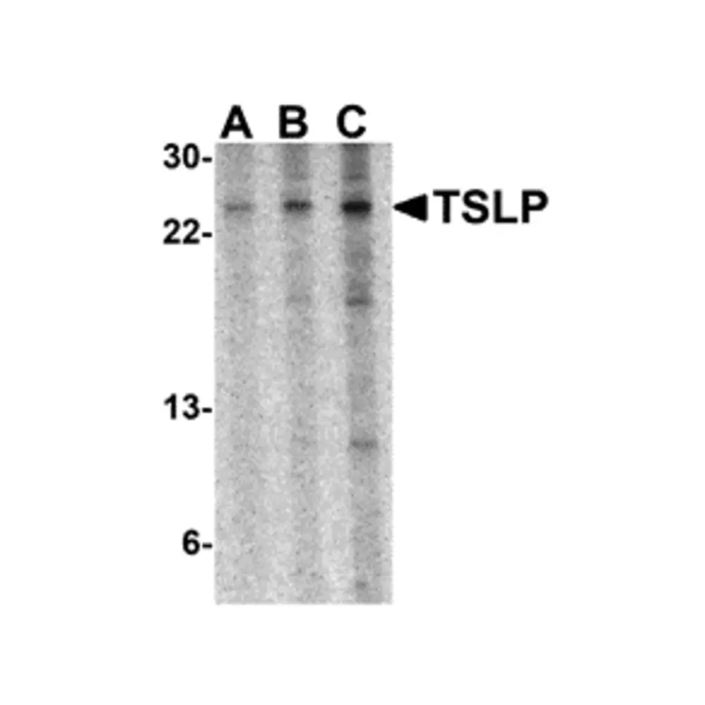 ProSci 4025 TSLP Antibody, ProSci, 0.1 mg/Unit Primary Image