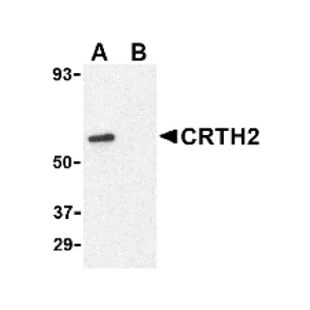 ProSci 4027 CRTH2 Antibody, ProSci, 0.1 mg/Unit Primary Image