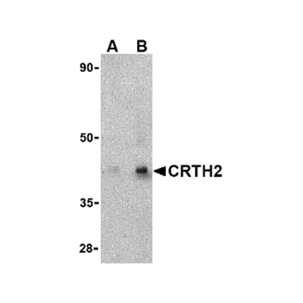 ProSci 4029 CRTH2 Antibody, ProSci, 0.1 mg/Unit Primary Image