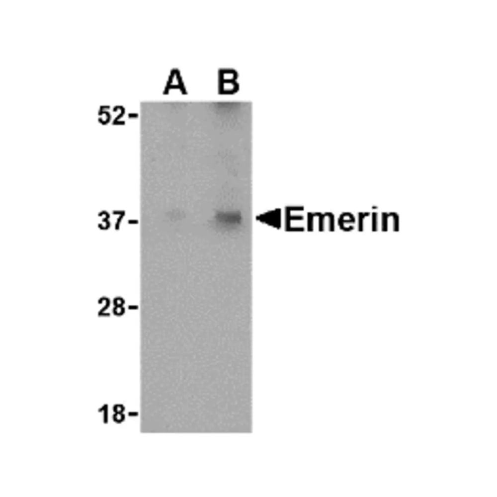 ProSci 4031_S Emerin Antibody, ProSci, 0.02 mg/Unit Primary Image
