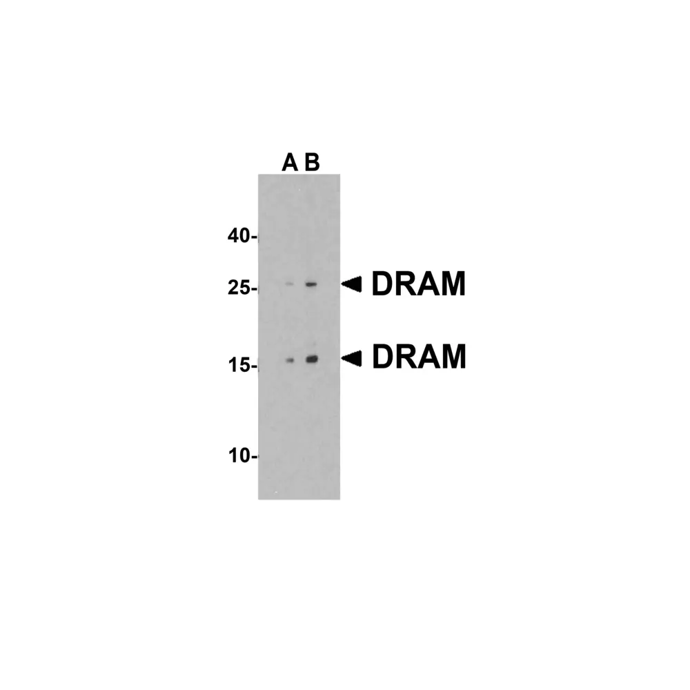 ProSci 4035 DRAM Antibody, ProSci, 0.1 mg/Unit Primary Image