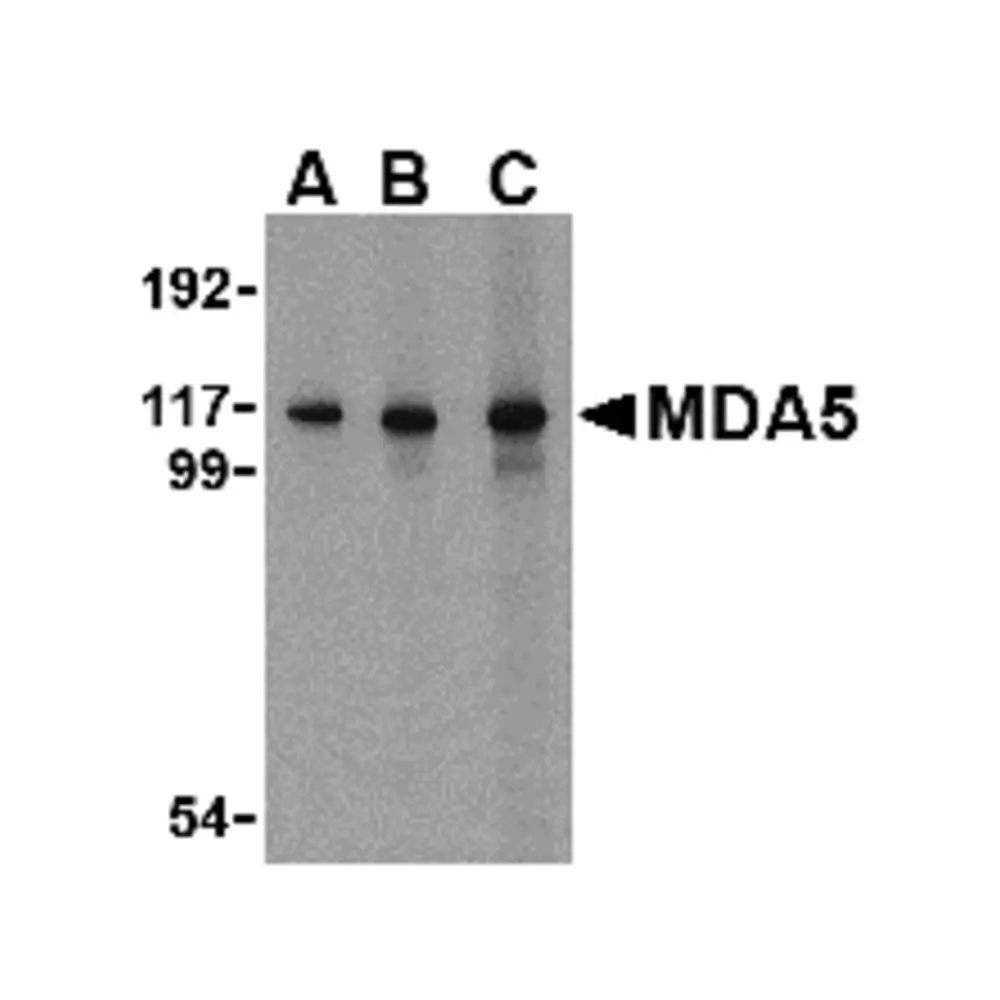 ProSci 4037 MDA5 Antibody, ProSci, 0.1 mg/Unit Primary Image