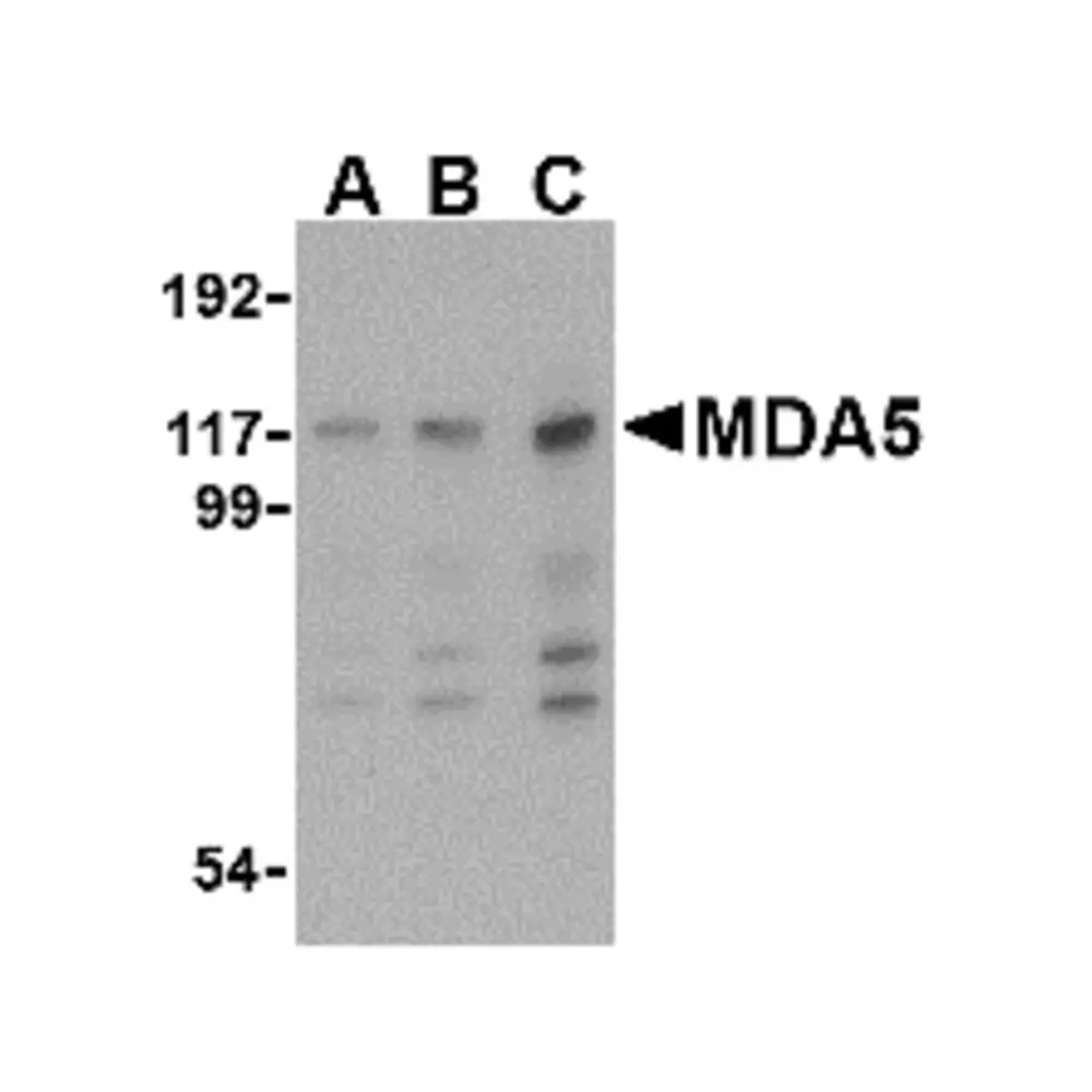 ProSci 4039 MDA5 Antibody, ProSci, 0.1 mg/Unit Primary Image