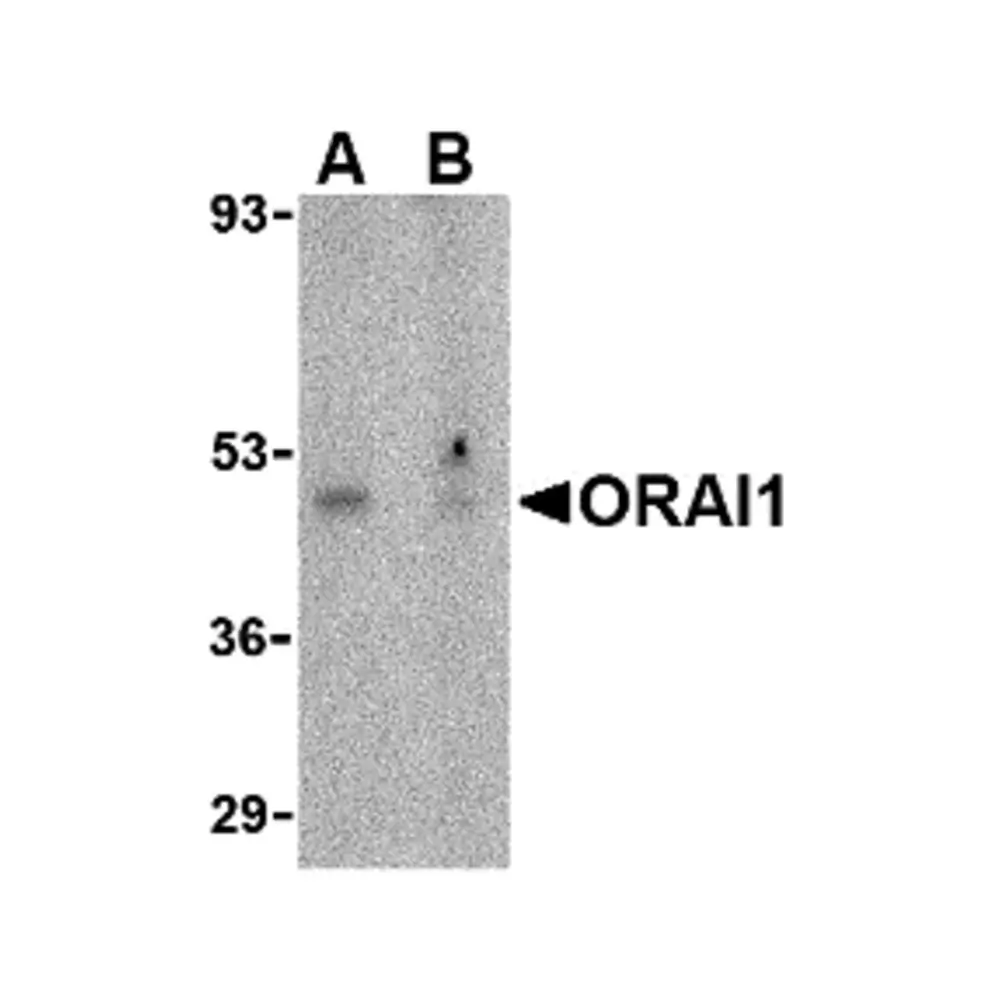 ProSci 4041_S ORAI1 Antibody, ProSci, 0.02 mg/Unit Primary Image