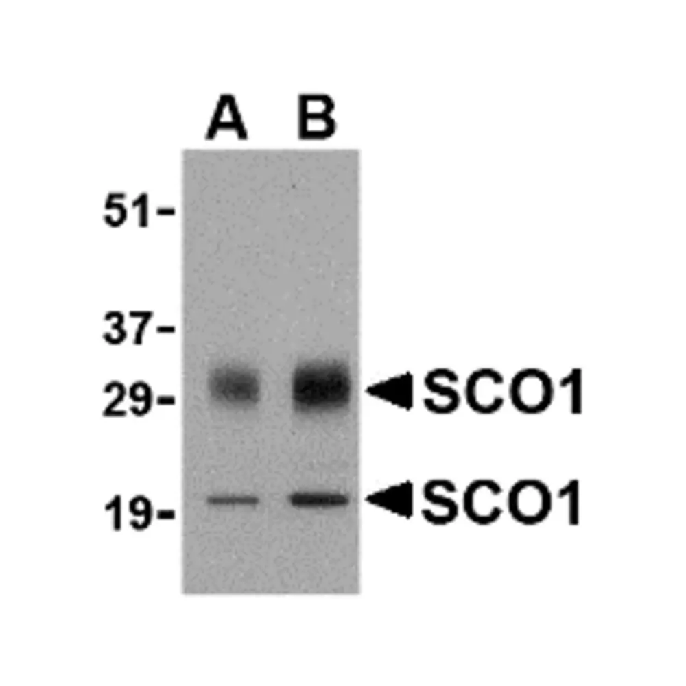 ProSci 4043_S SCO1 Antibody, ProSci, 0.02 mg/Unit Primary Image