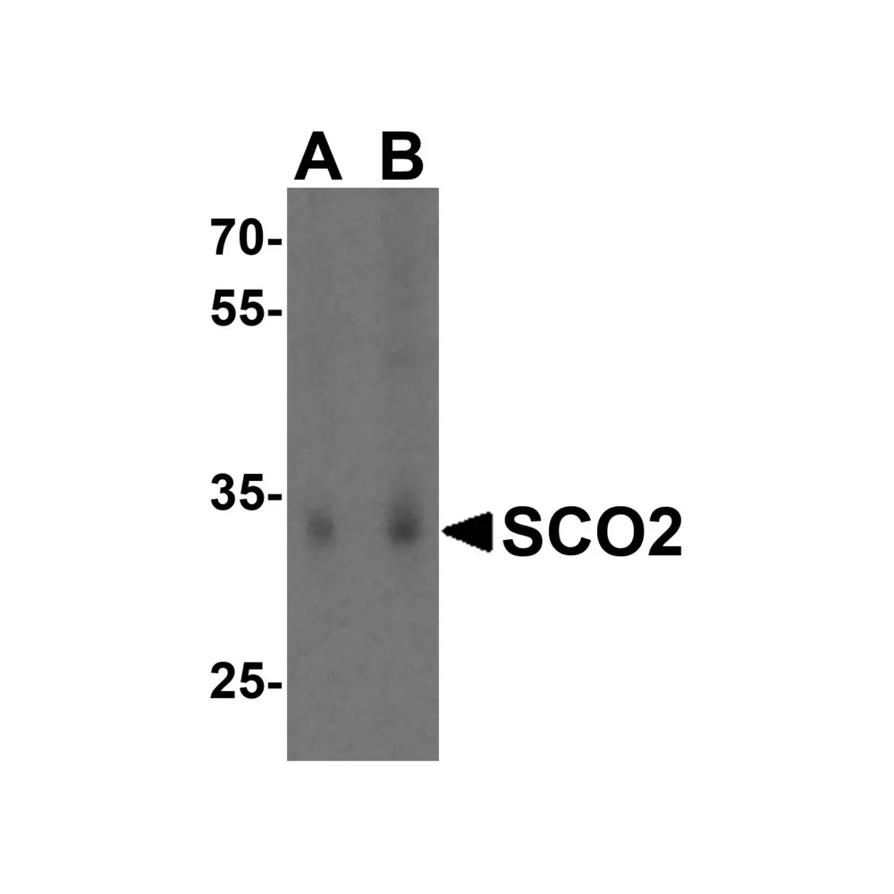 ProSci 4045_S SCO2 Antibody, ProSci, 0.02 mg/Unit Primary Image
