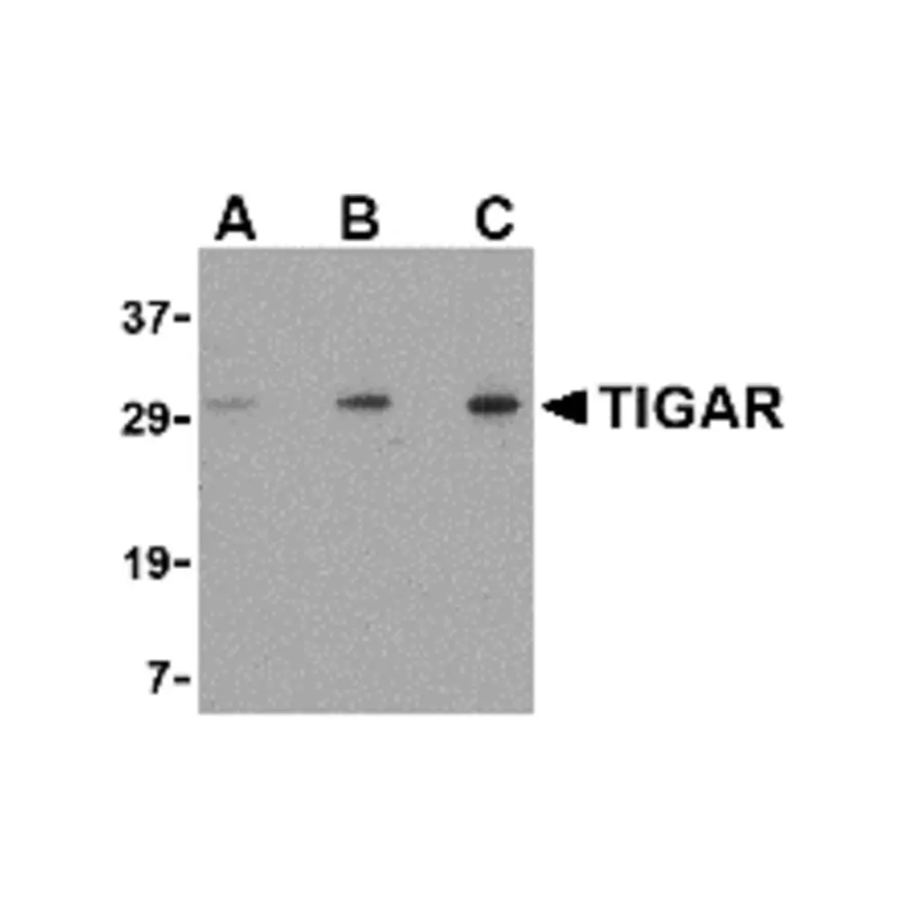 ProSci 4049 TIGAR Antibody, ProSci, 0.1 mg/Unit Primary Image