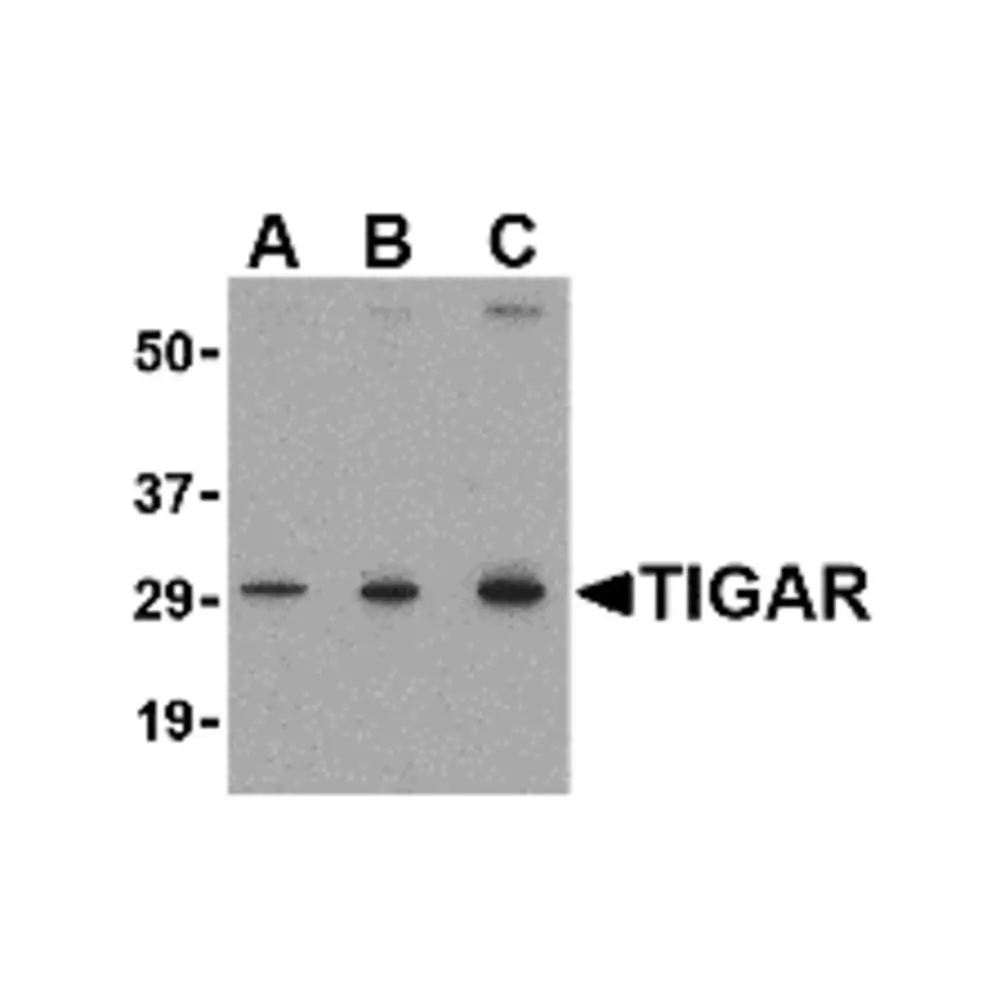 ProSci 4051 TIGAR Antibody, ProSci, 0.1 mg/Unit Primary Image