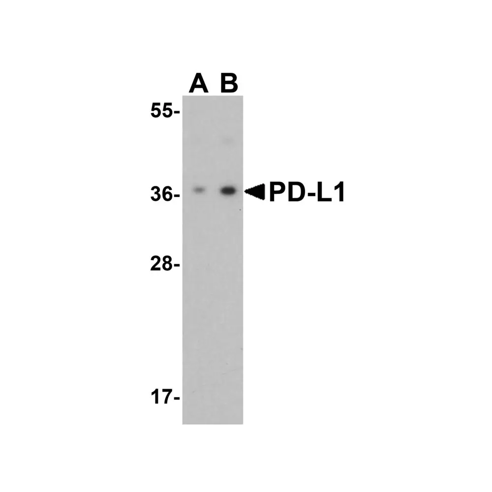 ProSci 4059_S PD-L1 Antibody, ProSci, 0.02 mg/Unit Primary Image