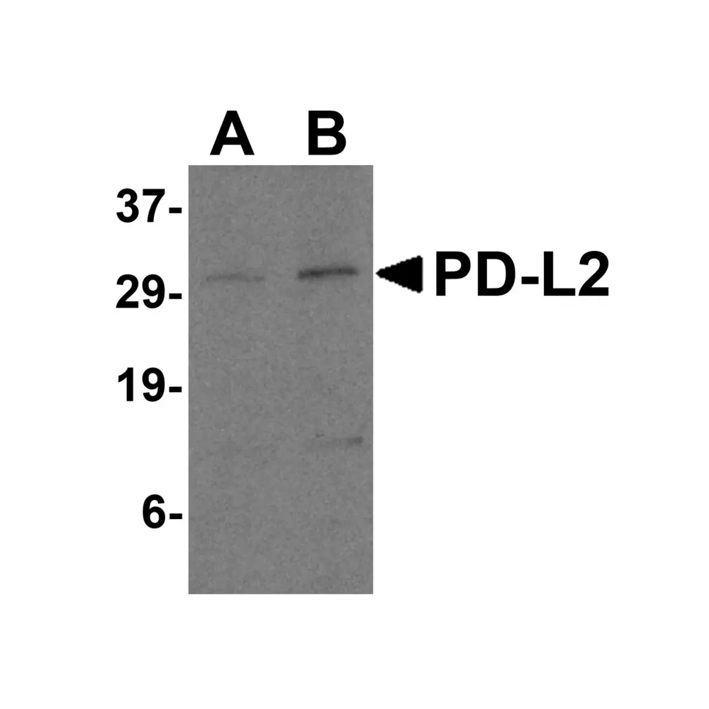ProSci 4063_S PD-L2 Antibody, ProSci, 0.02 mg/Unit Primary Image