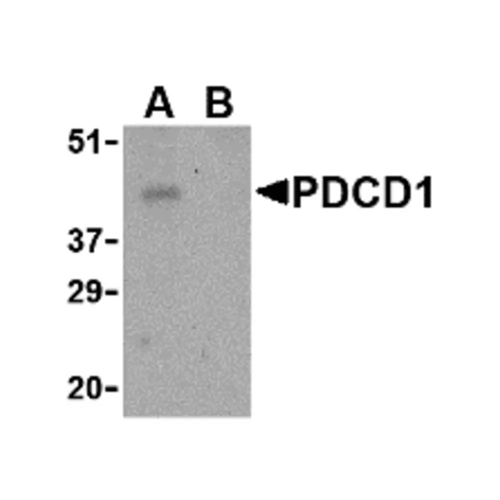 ProSci 4067 PD-1 Antibody, ProSci, 0.1 mg/Unit Primary Image
