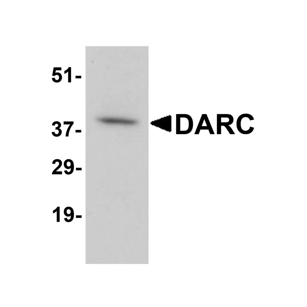 ProSci 4069_S DARC Antibody, ProSci, 0.02 mg/Unit Primary Image