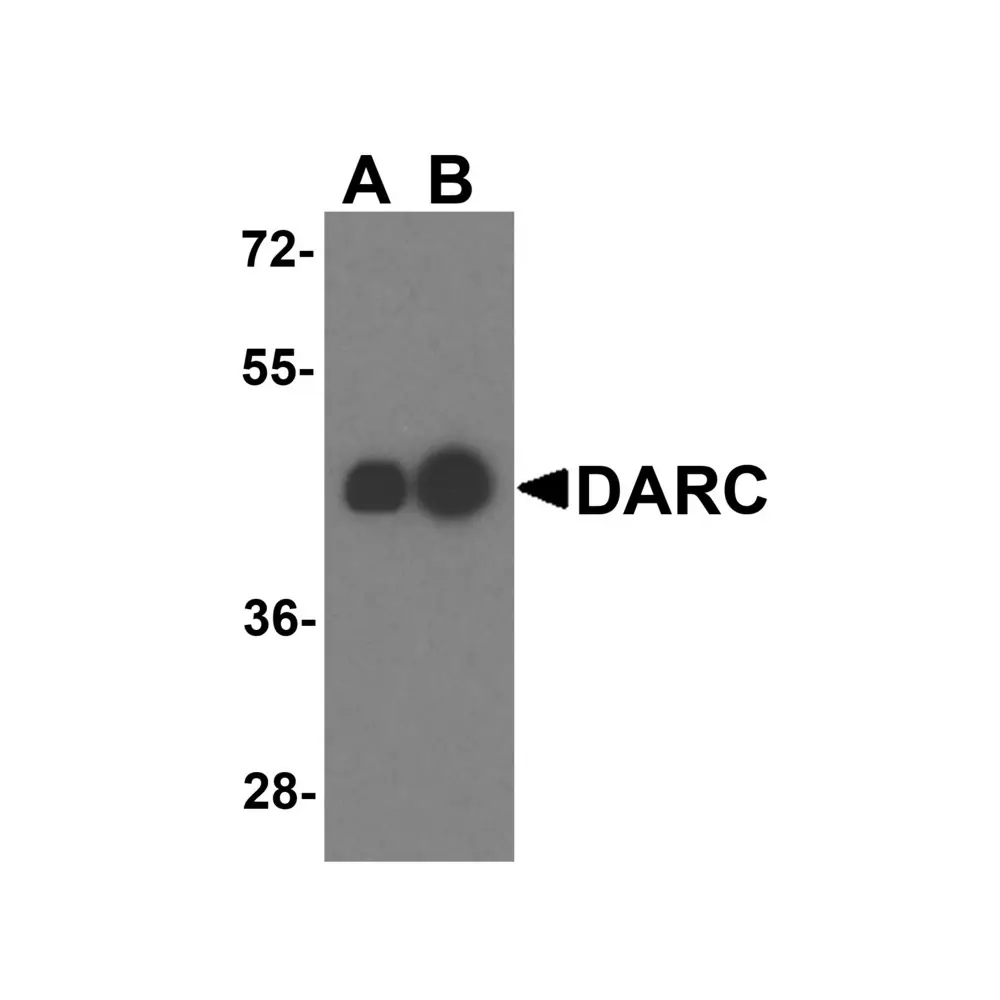 ProSci 4071_S DARC Antibody, ProSci, 0.02 mg/Unit Primary Image