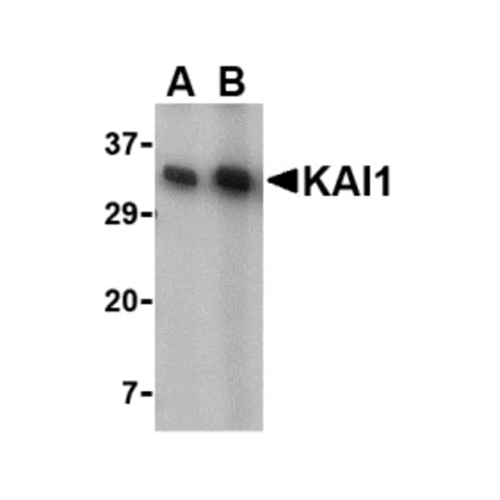 ProSci 4073 KAI1 Antibody, ProSci, 0.1 mg/Unit Primary Image
