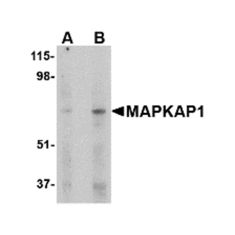 ProSci 4079 MAPKAP1 Antibody, ProSci, 0.1 mg/Unit Primary Image